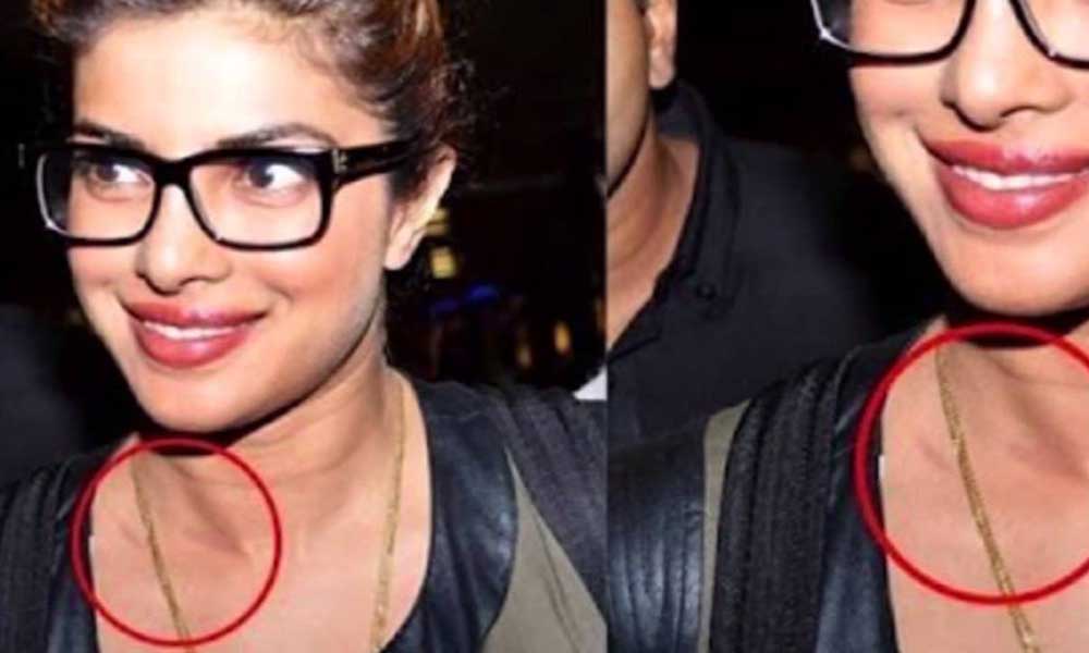 सेलिब्रिटीज के लव बाइट्स