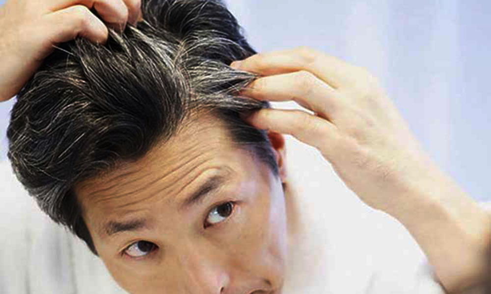 सफ़ेद बालों को काला करने के घरेलु उपाय