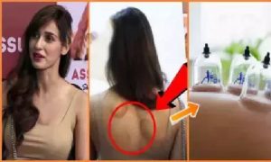 कंपिंग थेरेपी