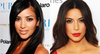 7 Famous Hollywood Celebs Who Looked Better Before Plastic Surgery