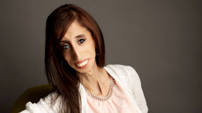 Lizzie Velasquez 7