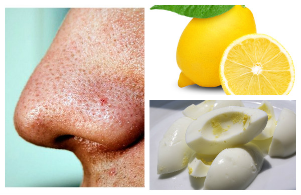 Facial Masks According To Your Skin Problem