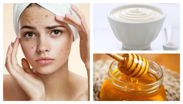 Facial Masks According To Your Skin Problem