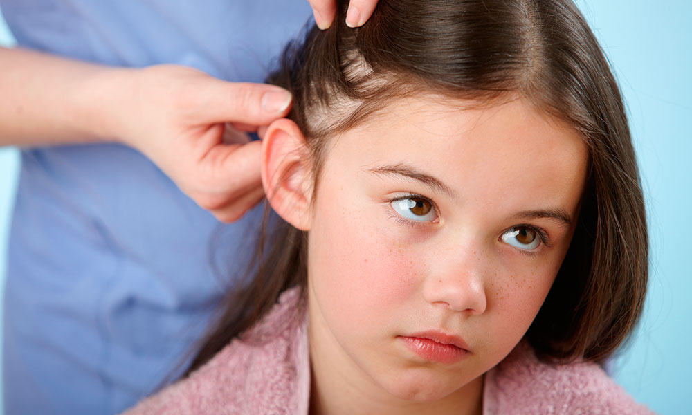 Ways To Prevent Head Lice