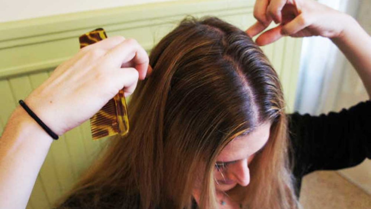 6 Remedies To Re-Grow Hair On The Crown Of Your Head!