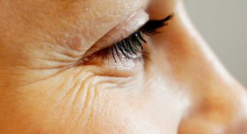 5 Home Remedies To Prevent Crow’s Feet!