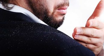 You Won’t Believe These Shocking Facts About Anti Dandruff Shampoos