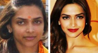 These Before And After Pictures of Actresses Prove That Money Can Do Anything