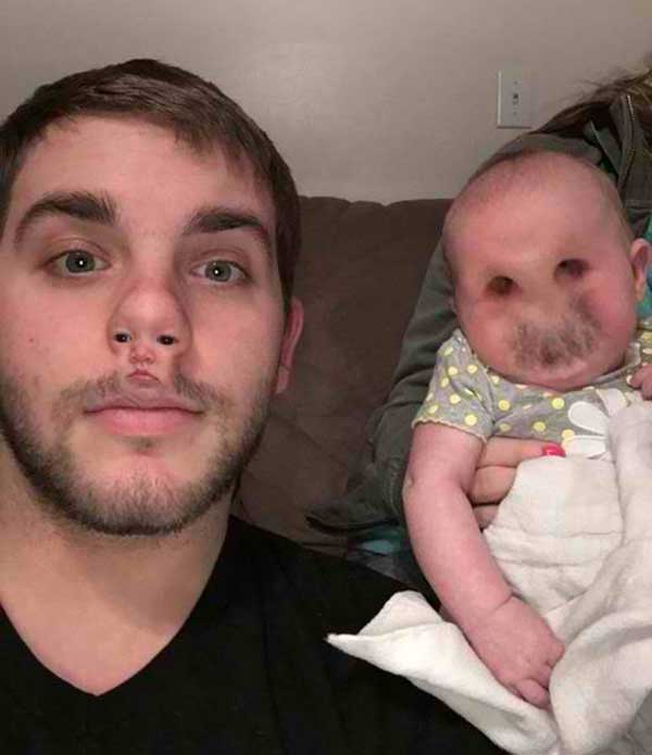 face swapping