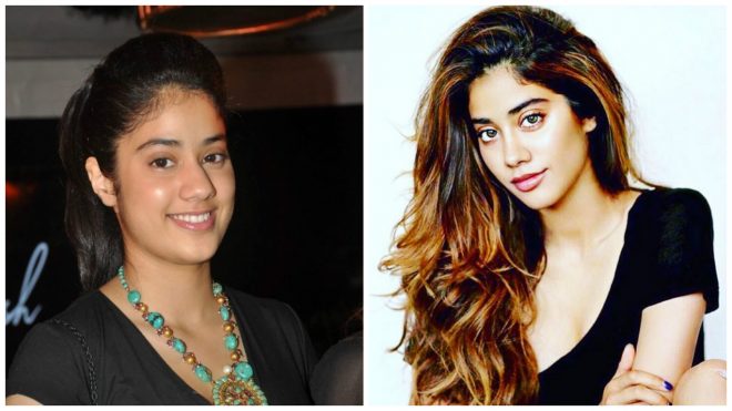 Jhanvi Kapoor Did A Nose Job