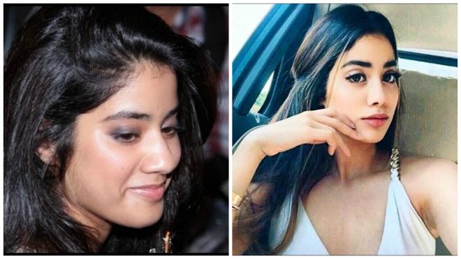 Jhanvi Kapoor Did A Nose Job