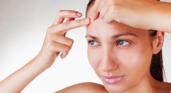 7 Home Remedies That’ll Help You Prevent Forehead Acne Immediately!