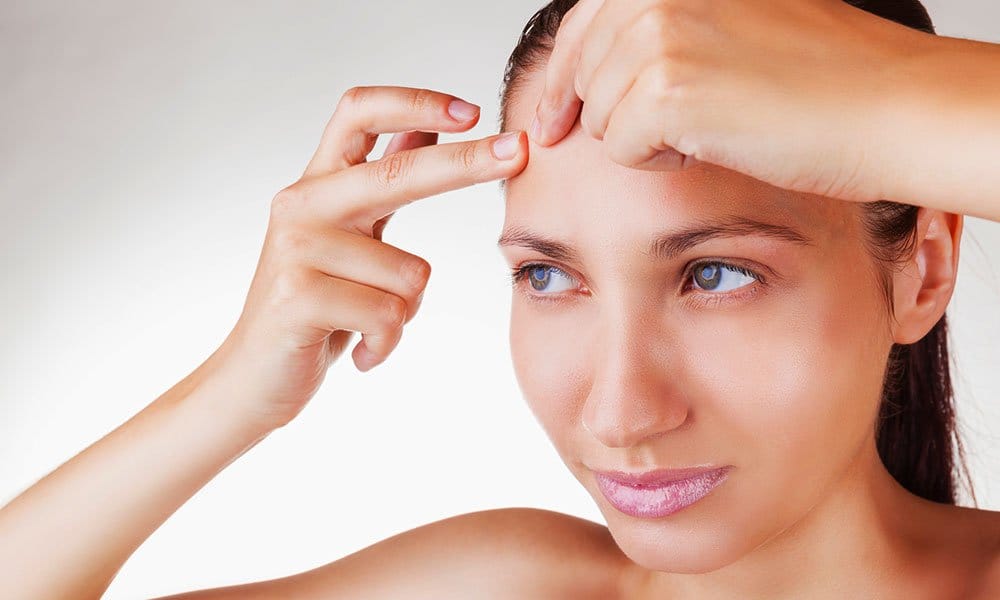 home remedies for forehead acne