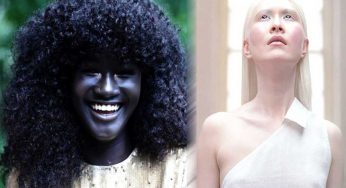 5 People With Unique Skin Color But Great Features Will Amaze You Completely