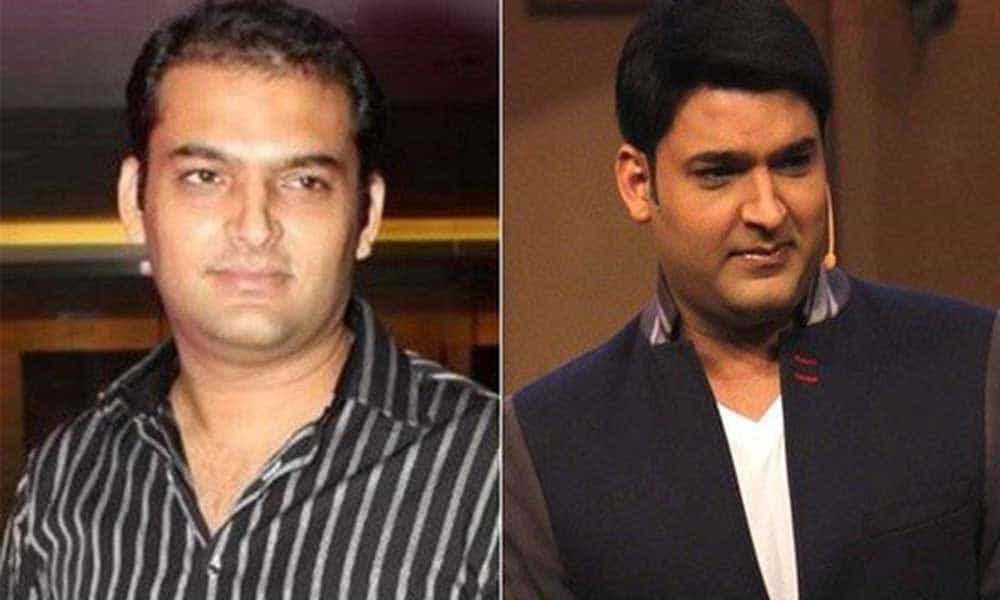 Here Is A List Of Bollywood Celebs Who Did Hair Transplant Surgery! Here Is A List Of Bollywood Celebs Who Did Hair Transplant Surgery!