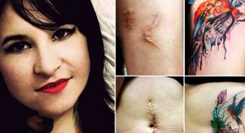 This Tattoo Artist Is Famous For Covering Up Domestic Violence Permanent Scars For Free!