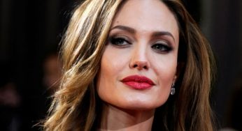 These Celebrities Have Physical Flaws That Make Them Extremely Special