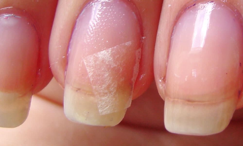 Broken Nail - Best Ways To Fix A Broken Nail If You Don't Want To Cut It