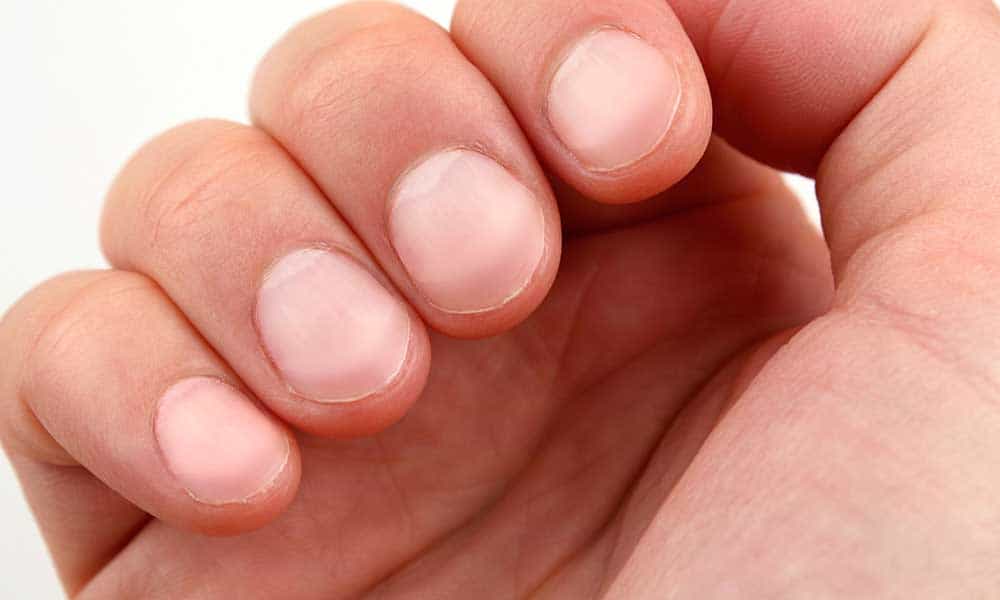 Nails that tell health condition