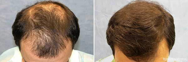 Slower metabolism rates