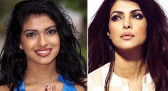 9 Bollywood Actresses Whose Plastic Surgeries Have Gone Wrong