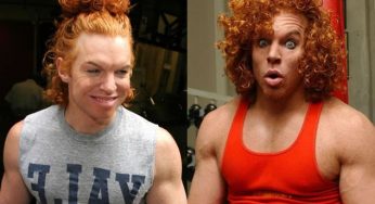 Hilarious Pictures of Plastic Surgeries Gone Wrong
