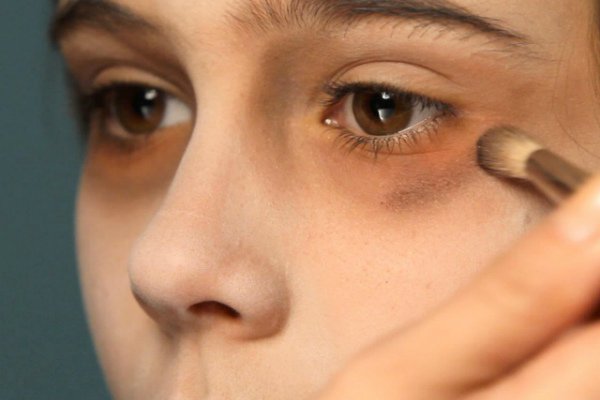 Reasons behind dark circles