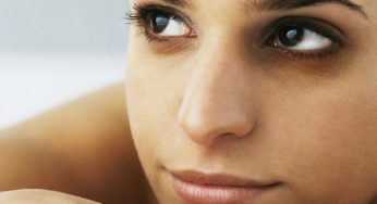 What Are The Reasons Behind Your Dark Circles?
