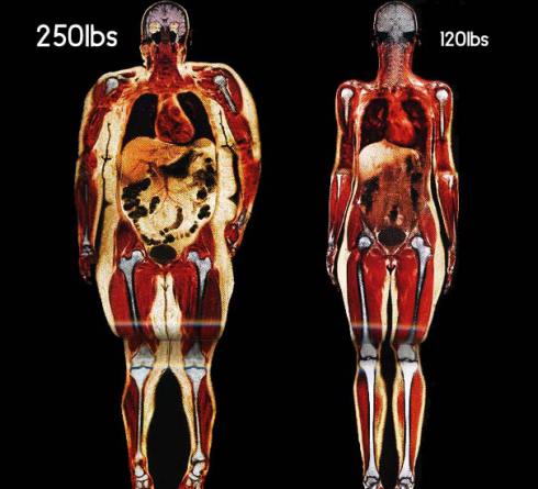 Fats in your diet