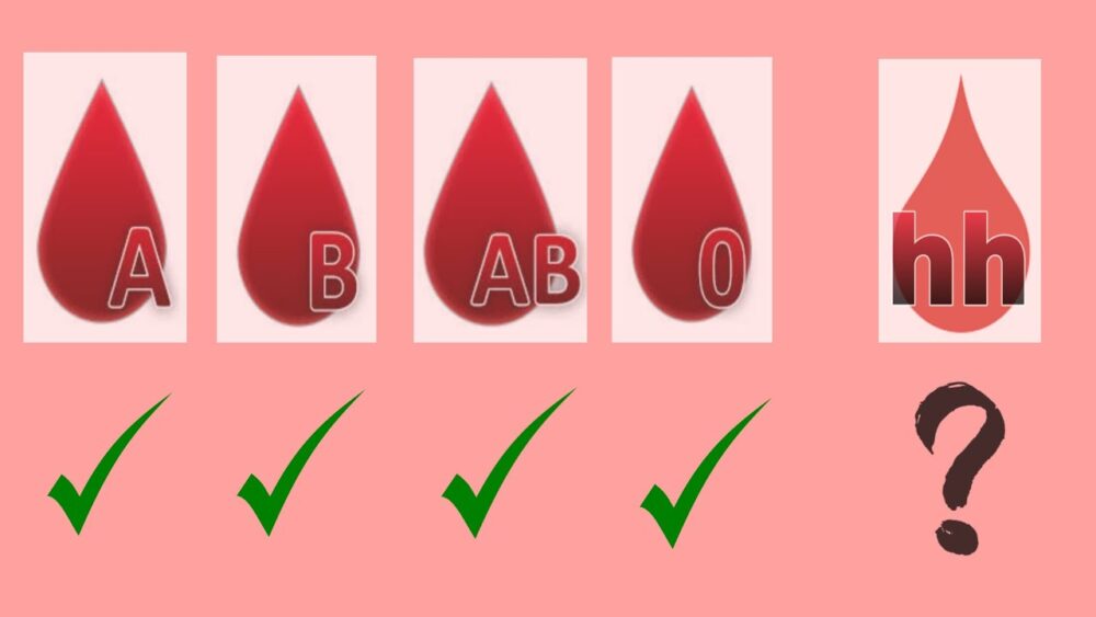 What Do You Know About the Rare HH Blood Group?