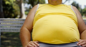 Treating obesity