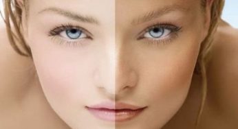 5 Homemade Face Packs To Remove Sun Tan