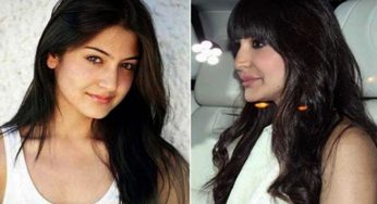 When Cosmetic Surgery Messed Up Bollywood Faces!!